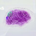 Como usar Inteligência Artificial na cobrança recorrente e preventiva